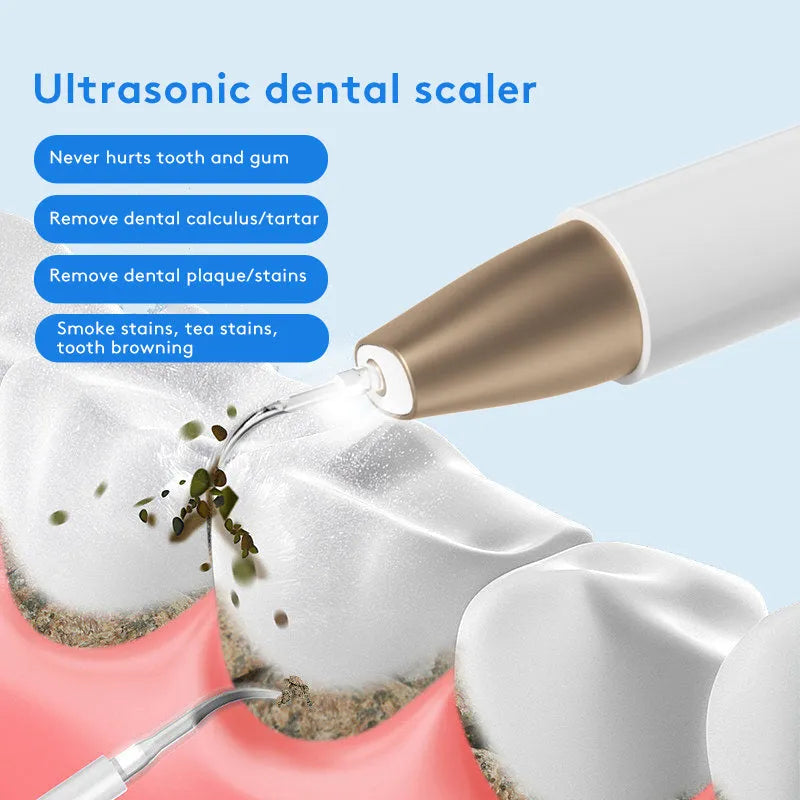 Gold-plated ultrasonic tooth cleaner for tartar and stain removal