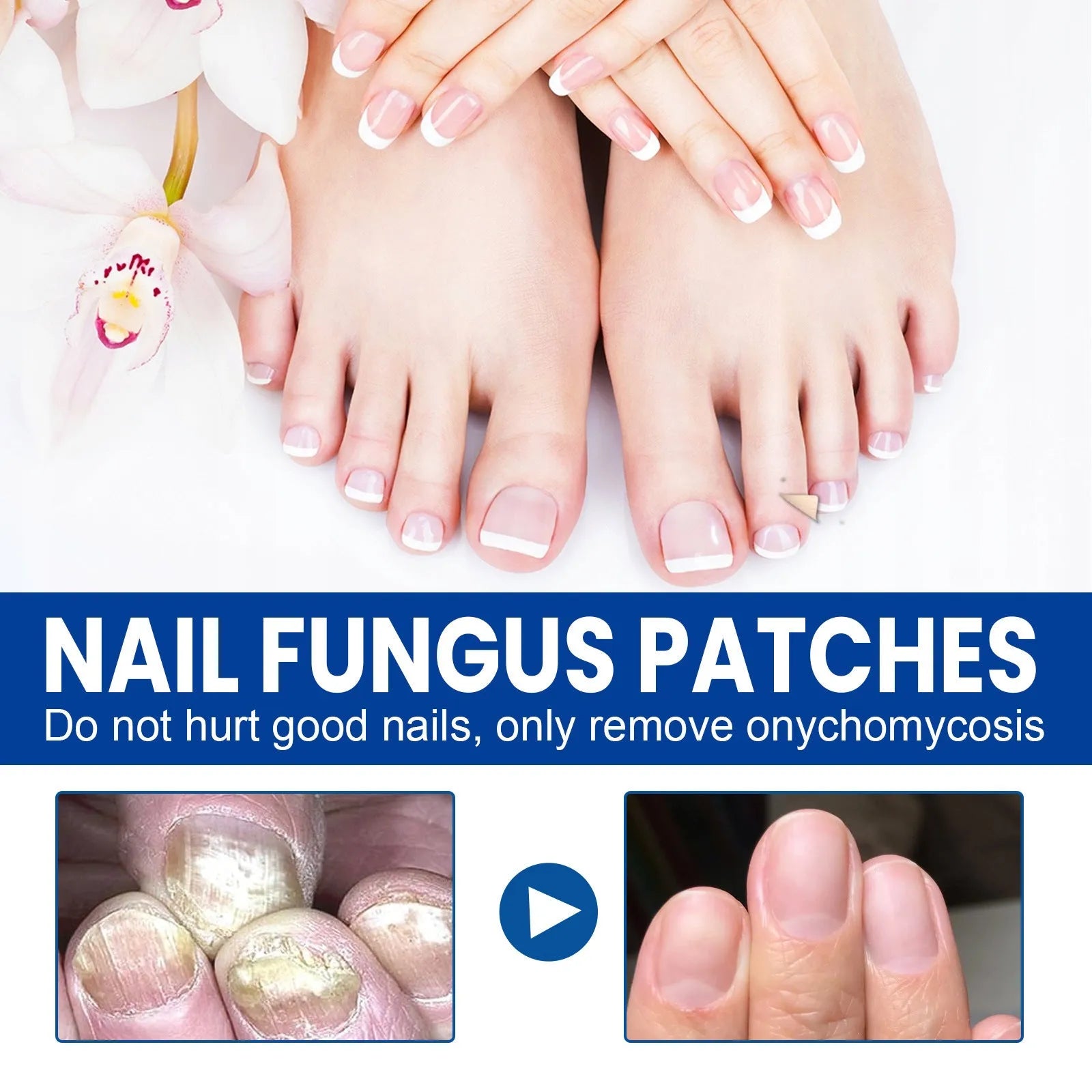 Nail repair adhesive bandage patches measuring 6.1 x 3.5 cm with glycerin, tea tree oil, and vitamin E ingredients