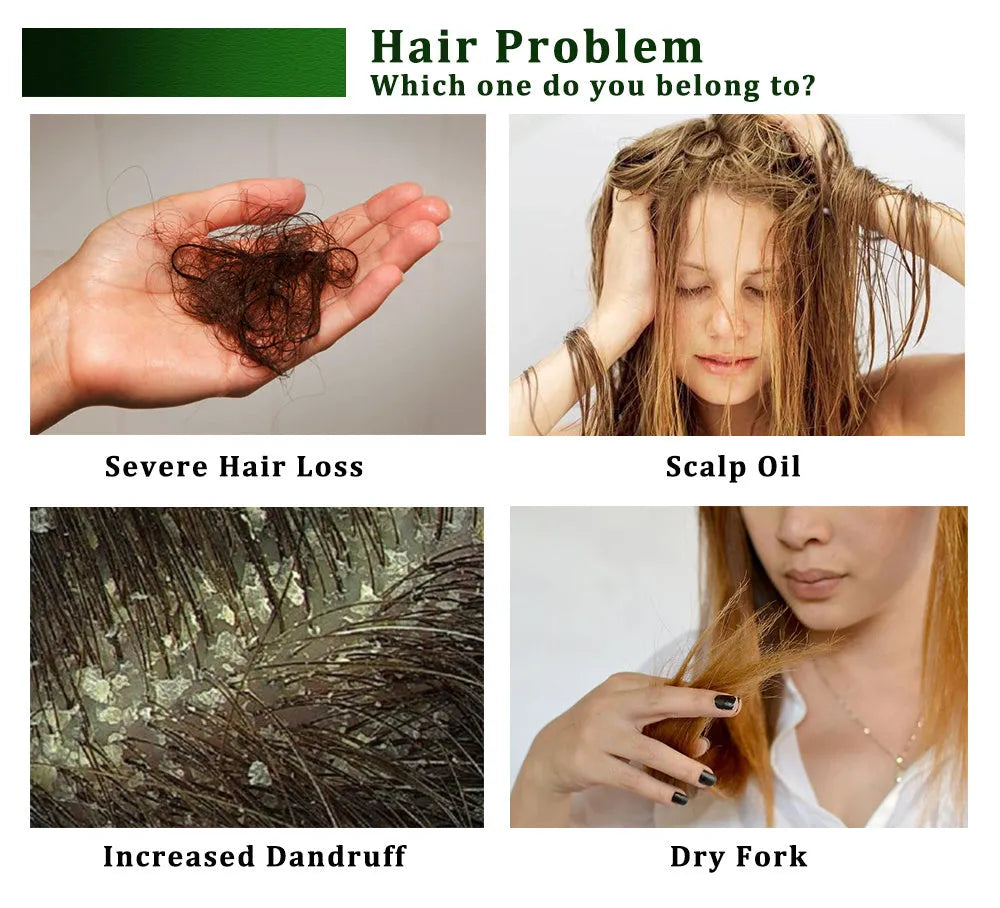 Lumia Oil 20ml hair treatment in green bottle with cap, placed on a flat surface