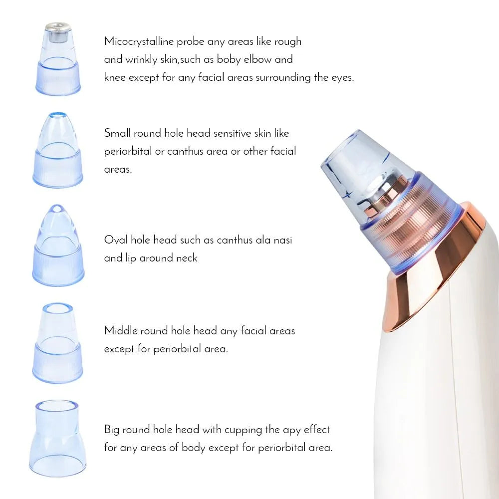 Electric blackhead remover vacuum device with interchangeable nozzles for pore cleaning