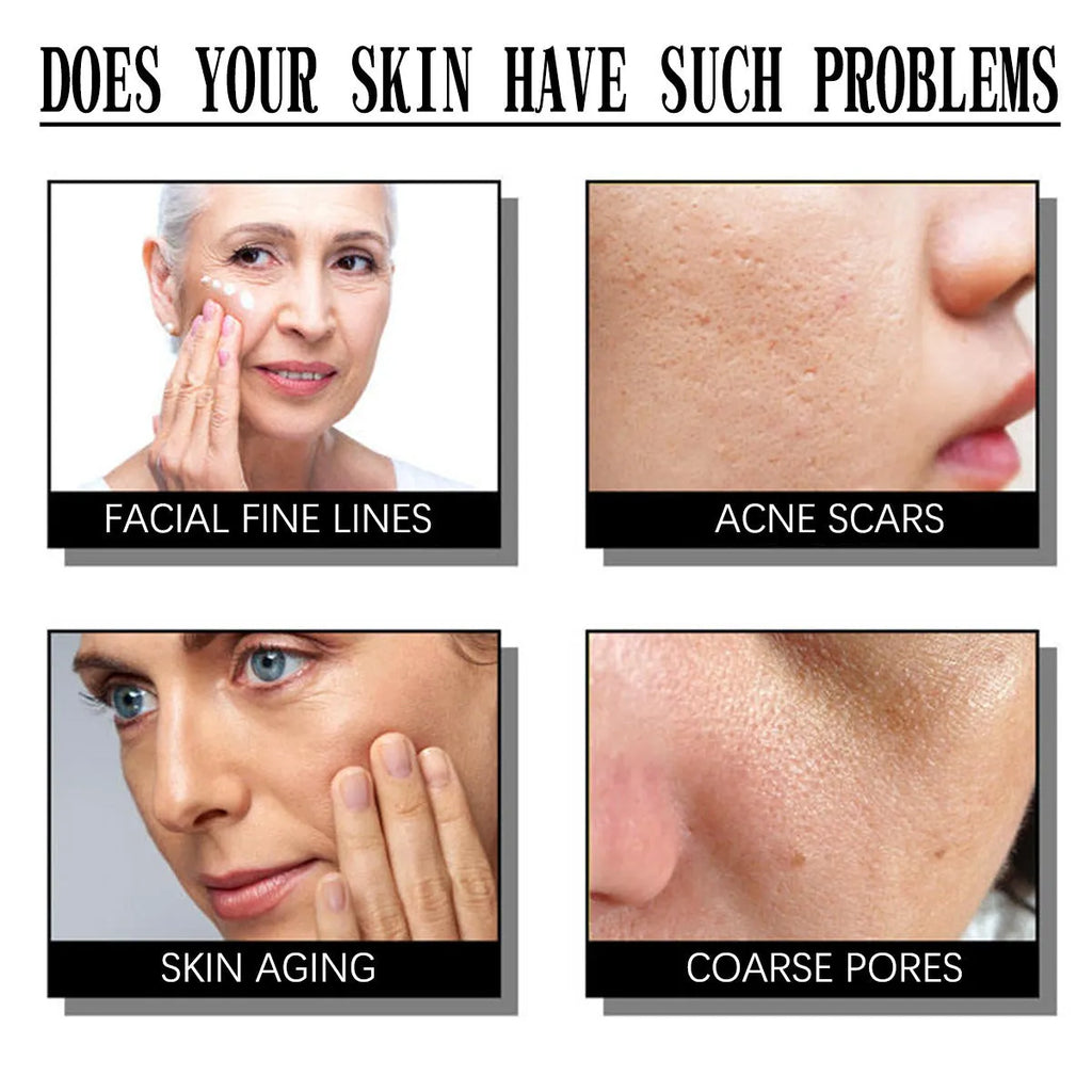Exfoliating salicylate nourishing moisturising cream 50g tube with universal skin type label