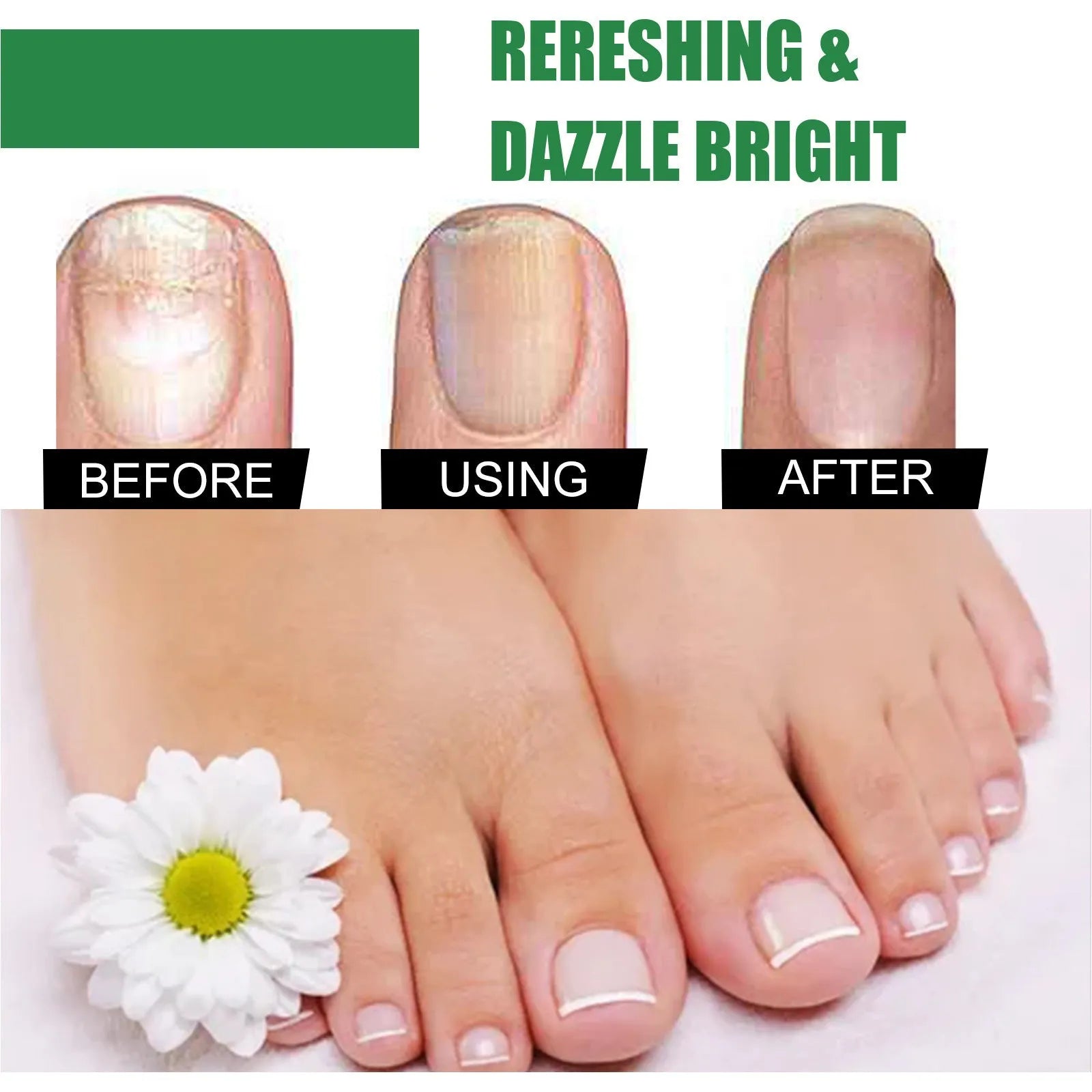 30ml tea tree oil foot nail repair fluid bottle for hand and foot nail care