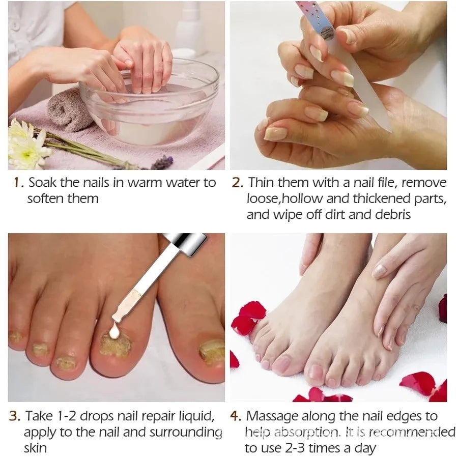 10ml Deck Liquid Antimicrobial foot treatment bottle for fungal care