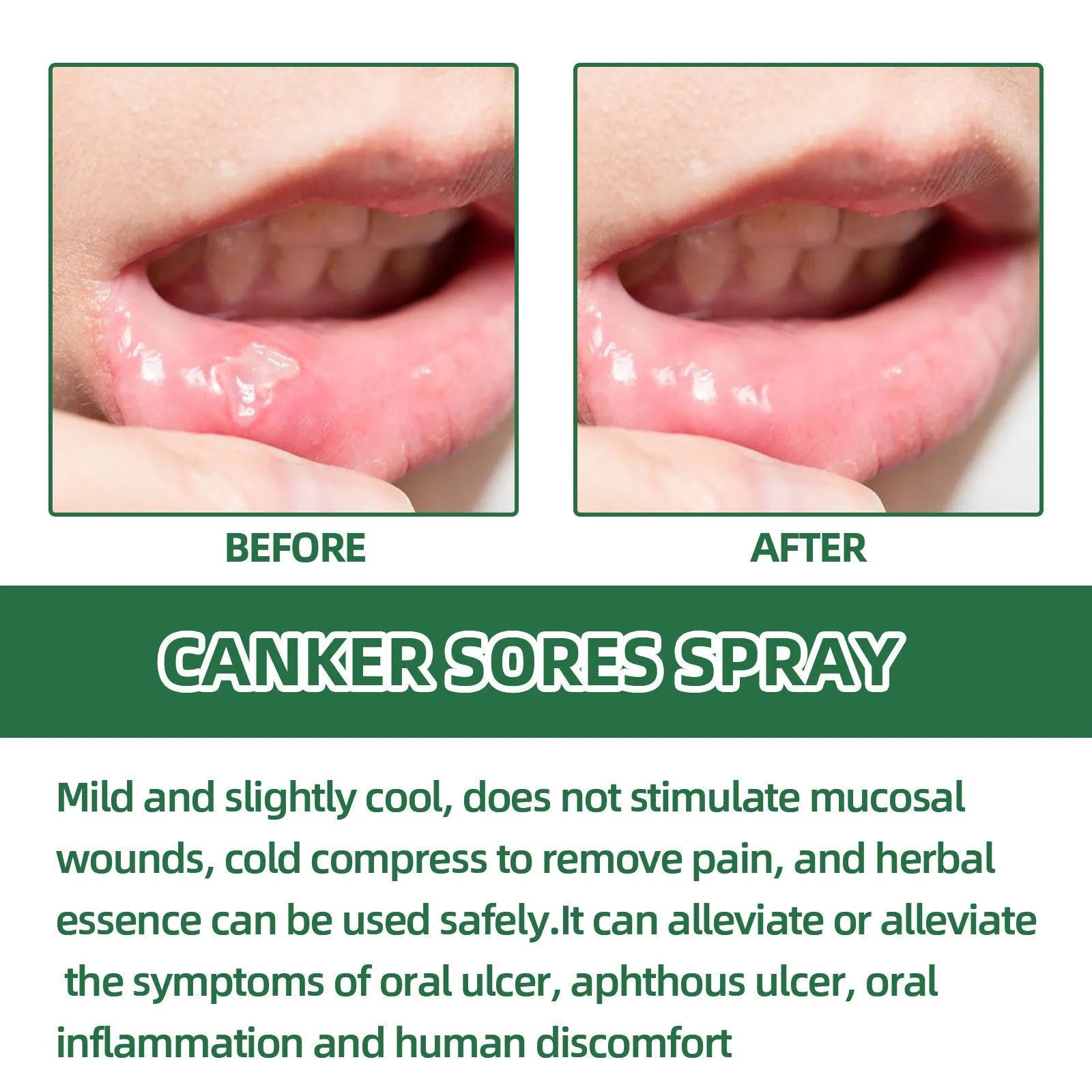 20ml breath cleaning oral care spray with mint flavour for adults portable bottle