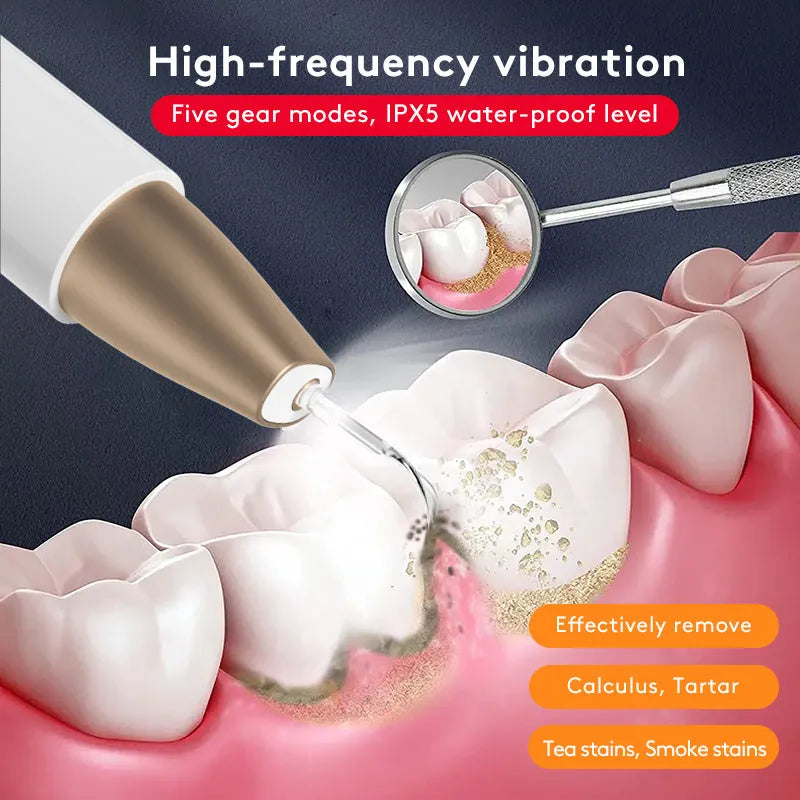 Gold-plated ultrasonic tooth cleaner for tartar and stain removal