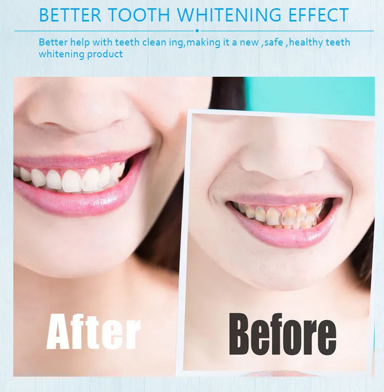 Teeth whitening pen with gel applicator, plastic or aluminium casing, multiple colour options