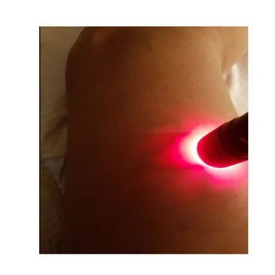Black Smart Vein Locator medical device with aluminium alloy body and red LED light.