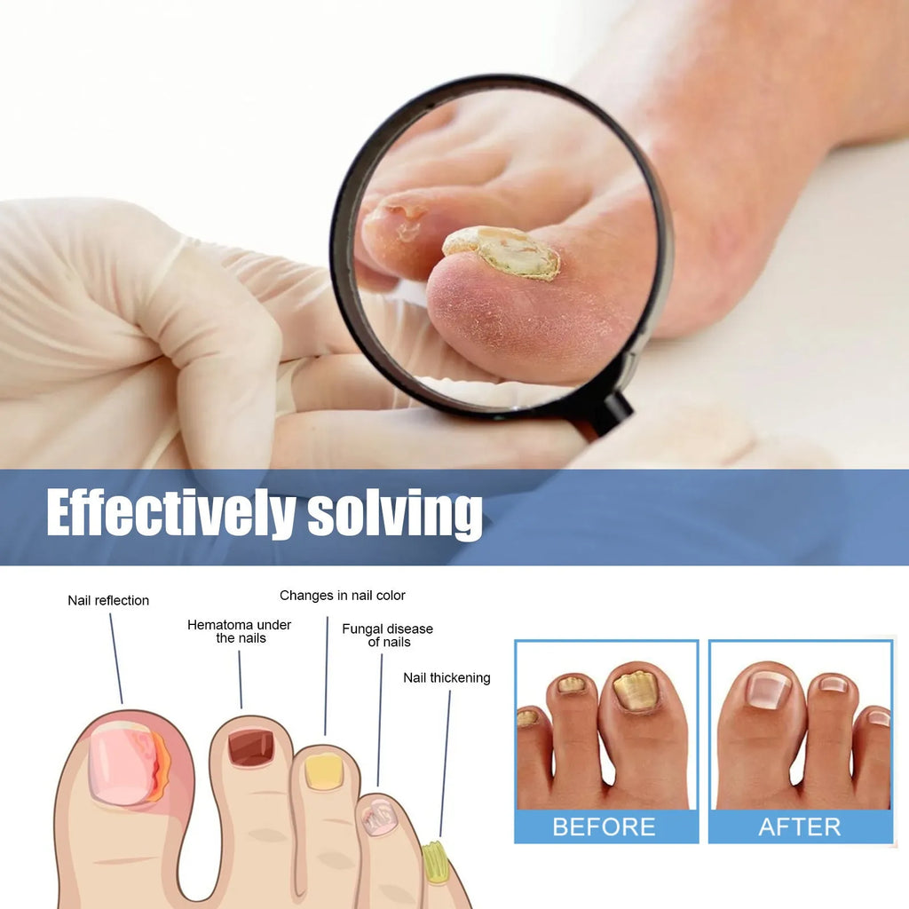 Nail repair adhesive bandage patches measuring 6.1 x 3.5 cm with glycerin, tea tree oil, and vitamin E ingredients