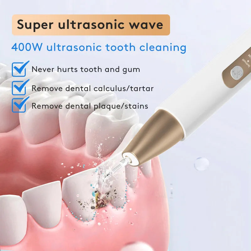 Gold-plated ultrasonic tooth cleaner for tartar and stain removal