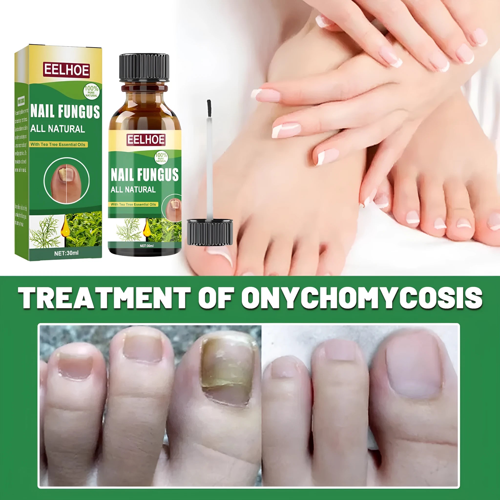 30ml tea tree oil foot nail repair fluid bottle for hand and foot nail care