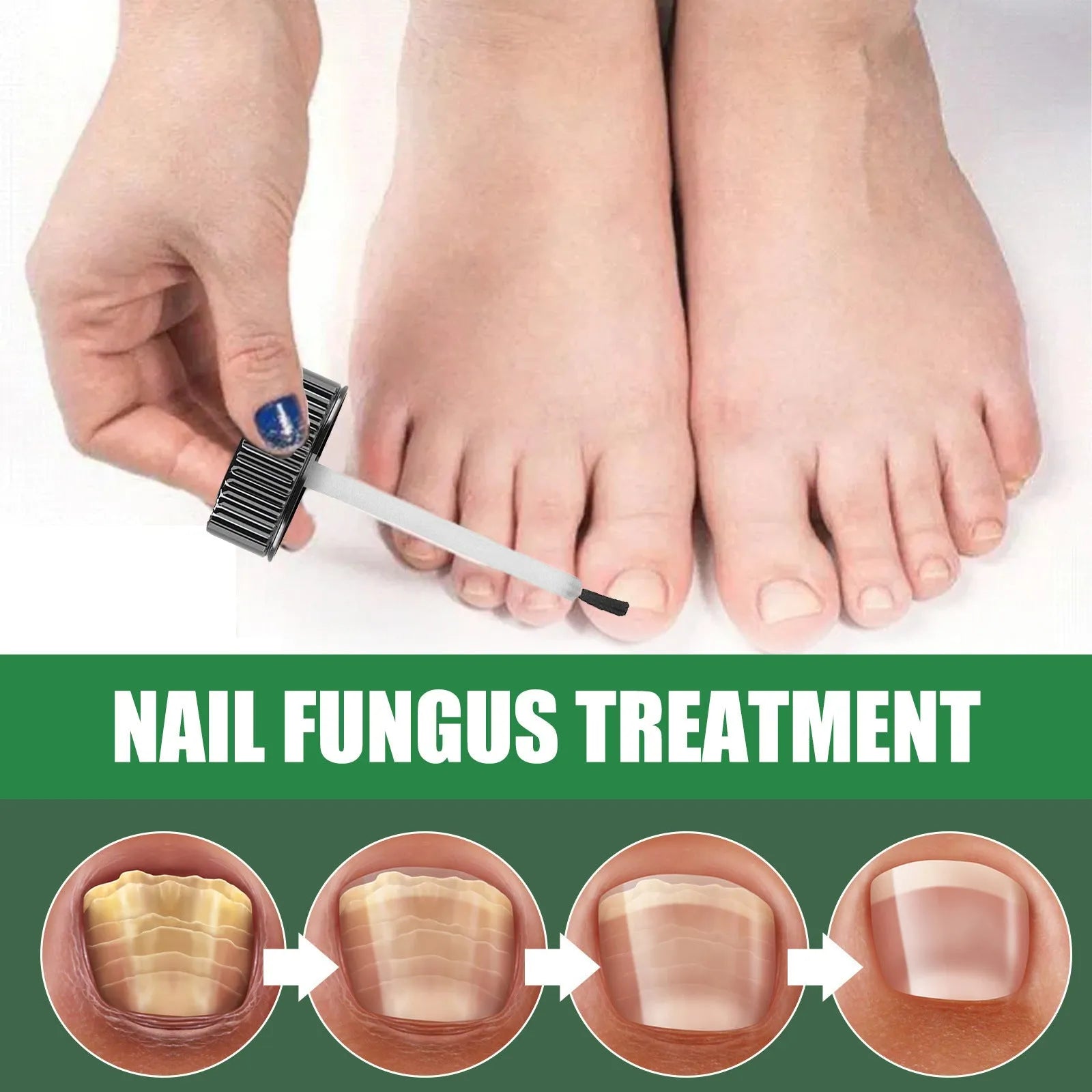 30ml tea tree oil foot nail repair fluid bottle for hand and foot nail care