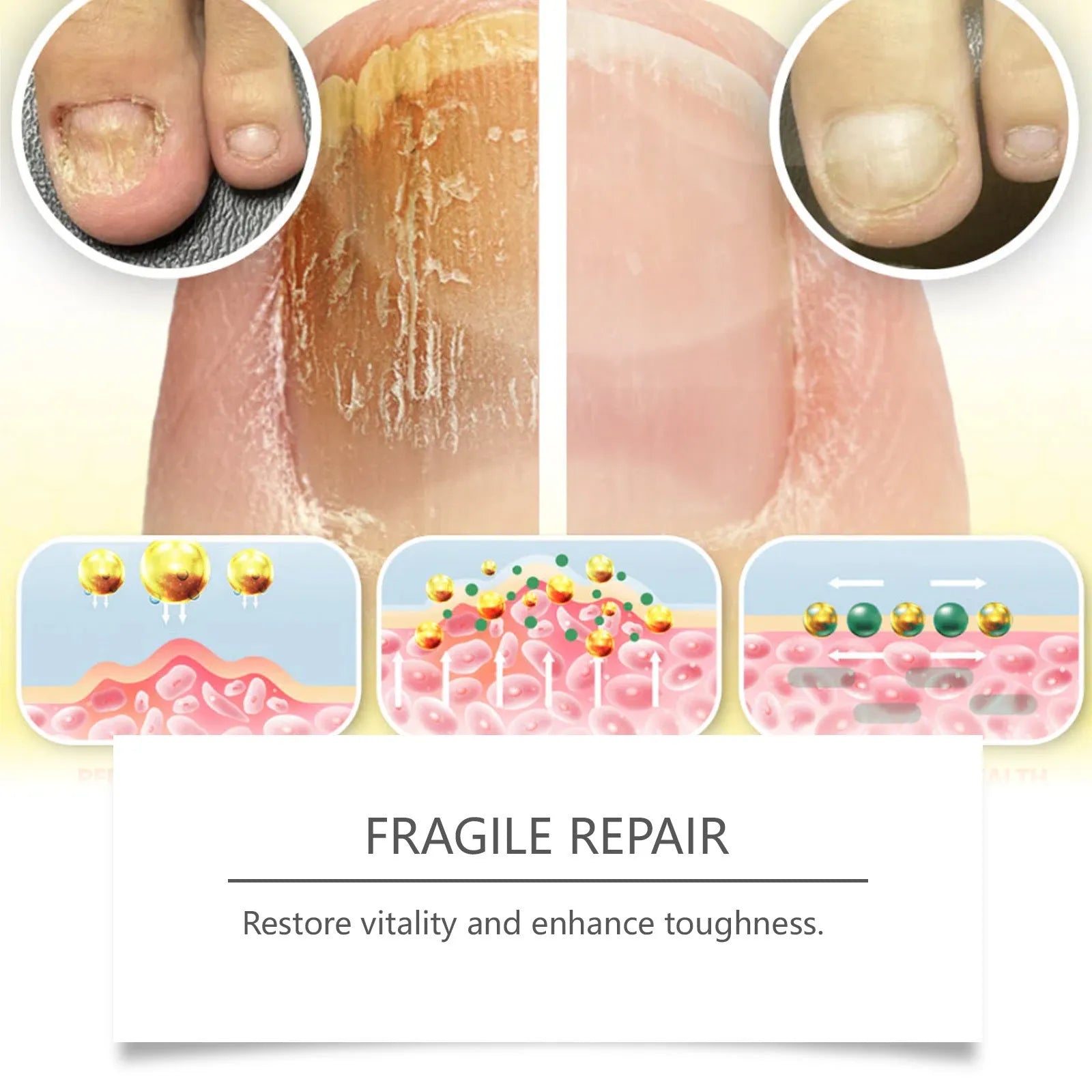 50ml nail fungus care solution bottle with bee venom and peppermint oil ingredients list