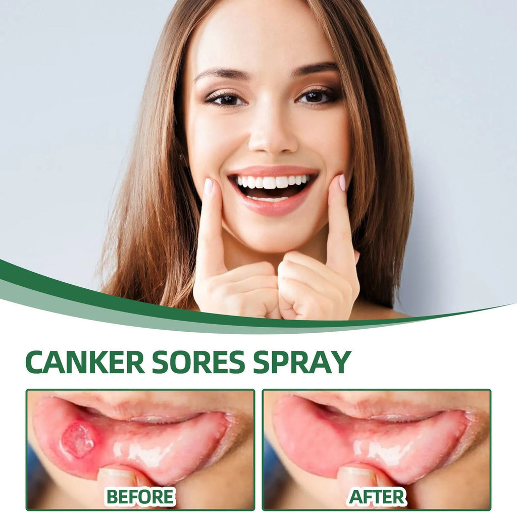 20ml breath cleaning oral care spray with mint flavour for adults portable bottle