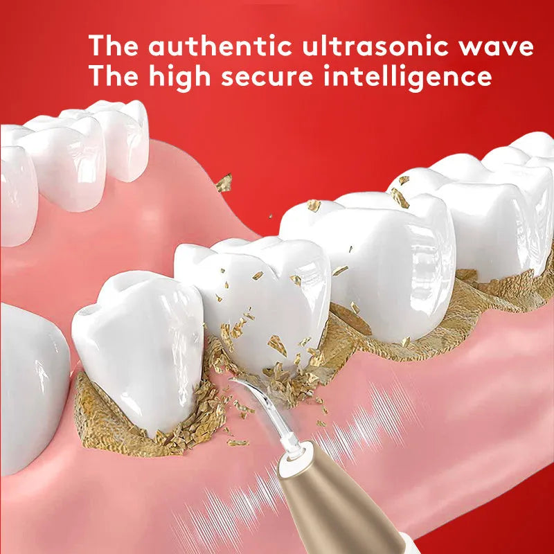Gold-plated ultrasonic tooth cleaner for tartar and stain removal
